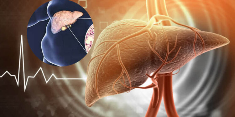 Fatty Liver को न करें नजरअंदाज! बढ़ सकता है हार्ट अटैक का खतरा, दिखें ये लक्षण तो तुरंत जाएं डॉक्टर के पास