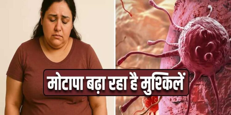 मोटापा-तनाव बढ़ा रहे कैंसर का खतरा! पुरुषों में ओरल तो महिलाओं में ब्रेस्ट कैंसर के मामले बढ़े