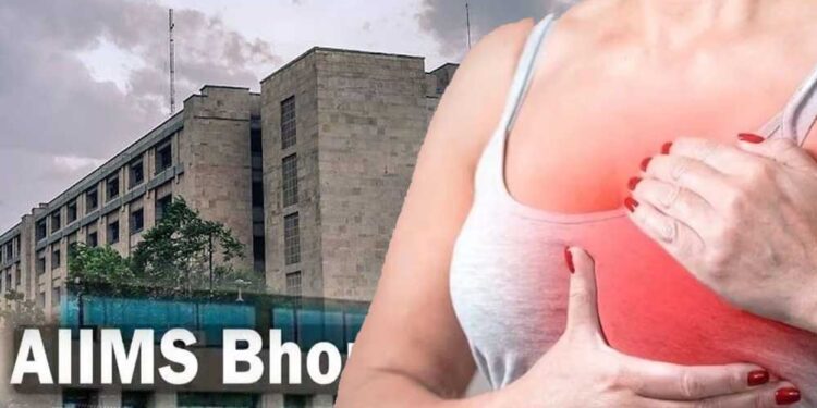 चौथे स्टेज के स्तन कैंसर में भी इलाज की उम्मीद, बीमारी की पहचान के आधार पर तय होगा उपचार
