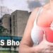 चौथे स्टेज के स्तन कैंसर में भी इलाज की उम्मीद, बीमारी की पहचान के आधार पर तय होगा उपचार
